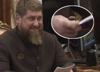 57250 An Electronic Device Was Again Spotted On Kadyrov’s Hand During A Meeting With Putin
